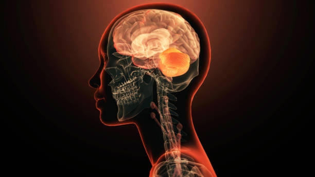 CT Scan vs MRI